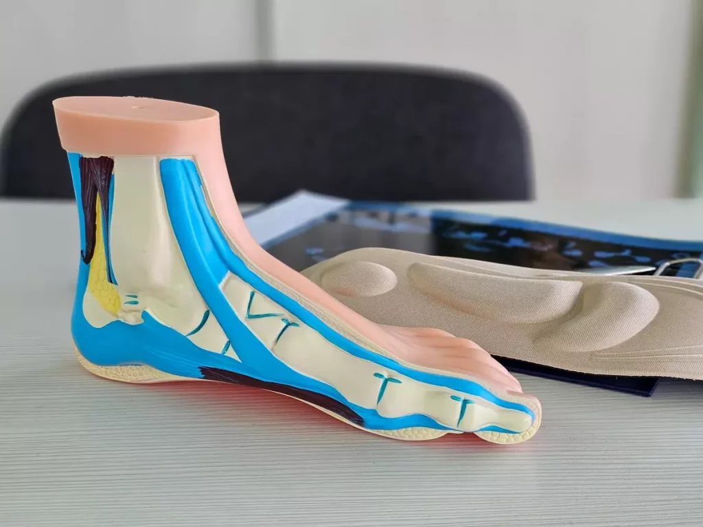 Orteza na opadającą stopę – kiedy jest konieczna i jak działa?